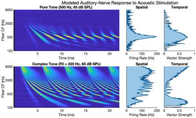 Computational Modeling of Synchrony in the Auditory Nerve in Response to Acoustic and Electric Stimulation